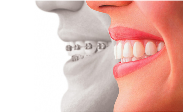 cosmetic dentistry in raleigh nc